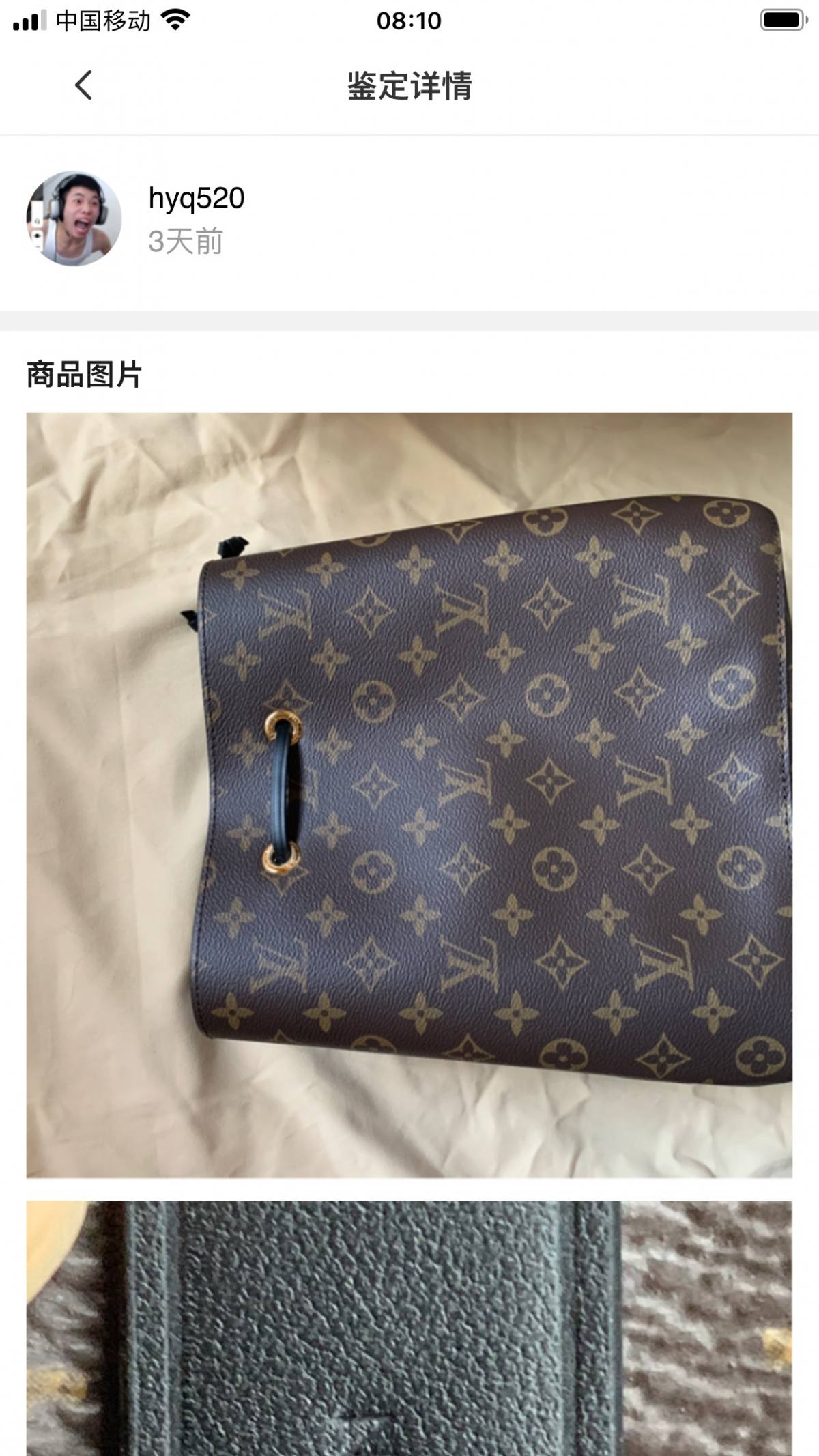 Ellebag’s 1:1 Replica of Louis Vuitton M44887 Caramel Bucket Bag: Recreating a Timeless Icon(2024 Dec updated)-Meilleure qualité de faux sac Louis Vuitton en ligne, réplique de sac de créateur ru